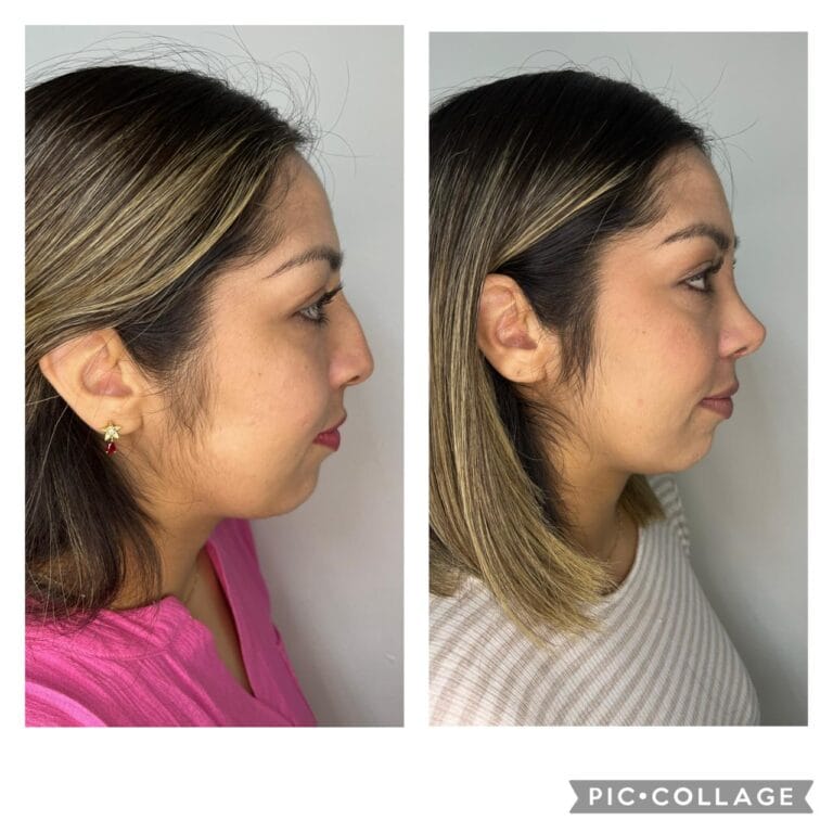 PHOTO-2024-10-30-20-39-22